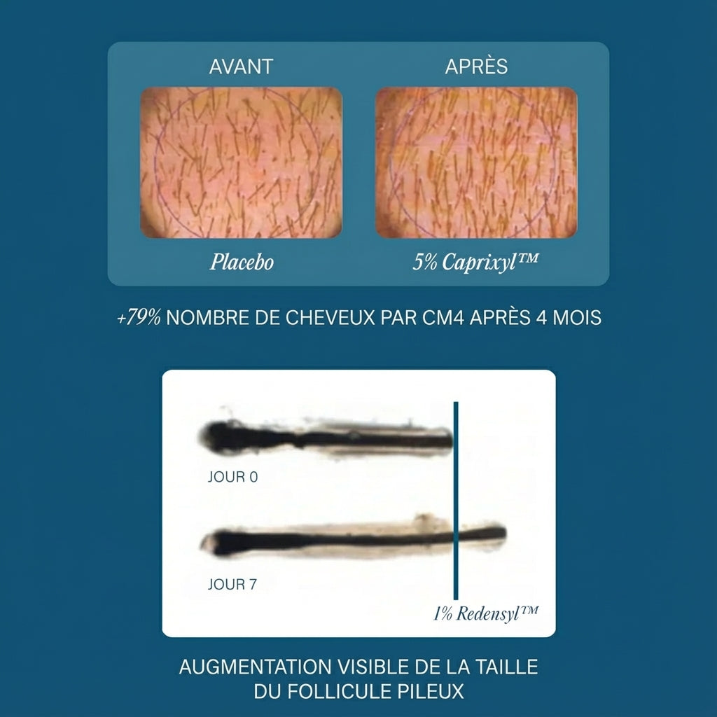 Sérum CHÉVÉA - Prévention & traitement