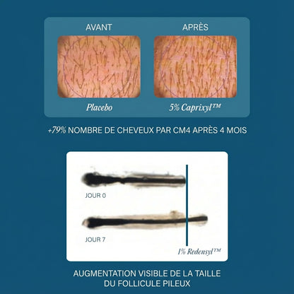 Sérum CHÉVÉA - Prévention & traitement